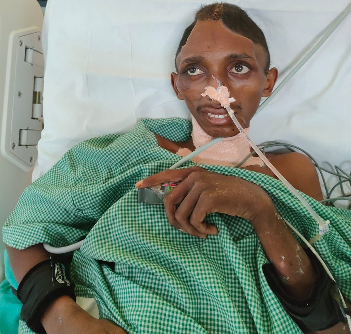 Post_Operative_Image